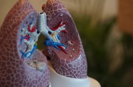 Operatyviai ir saugiai kovai su COVID-19 ir kitomis plaučių ligomis – KTU alumnų ir studentų kuriama unikali tyrimų sistema